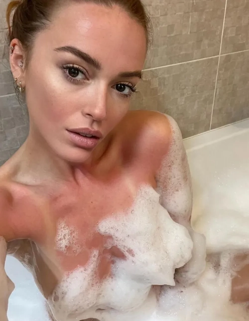 Chloechardonnay mym media leak - Photo 2 | French Modeles