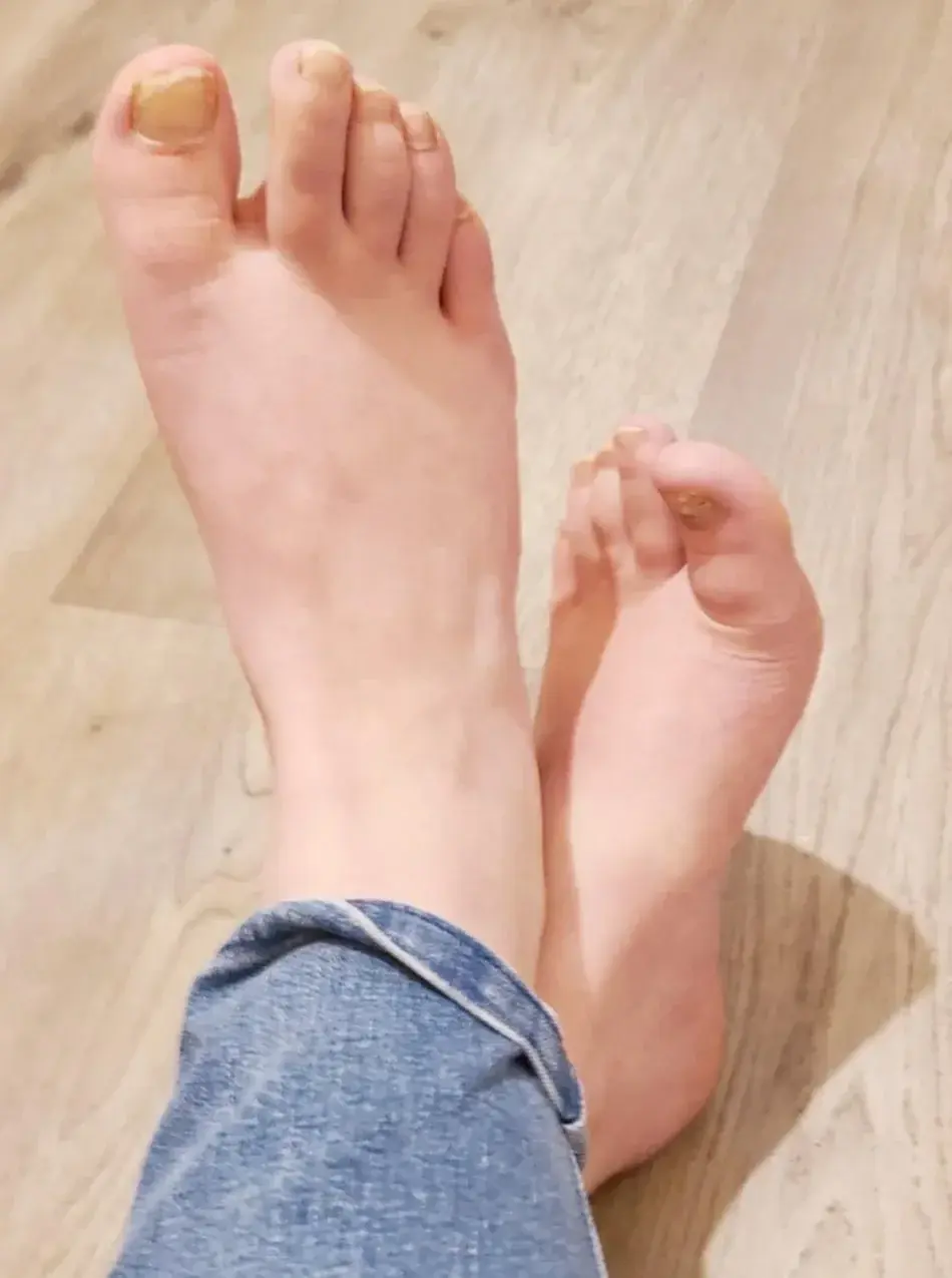 Leak & nude 1 — Lynsaysmart