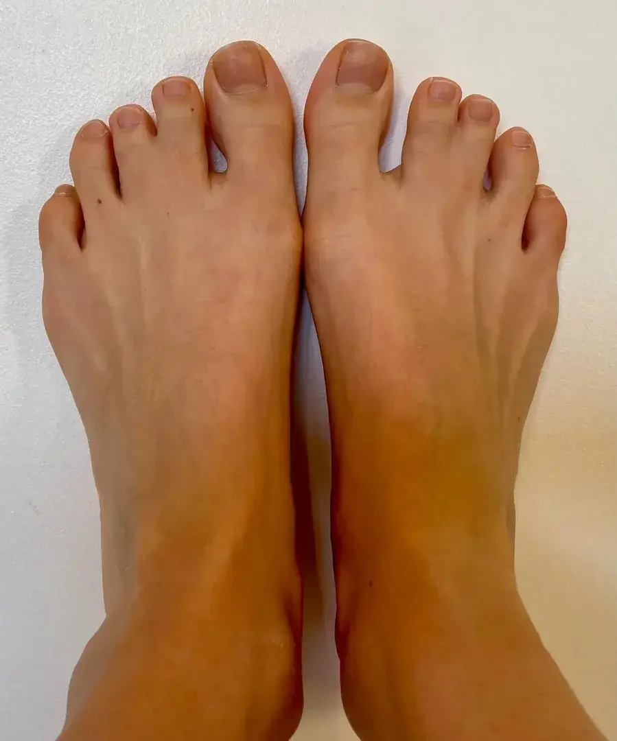 Leak & nude 1 — Twin_toes