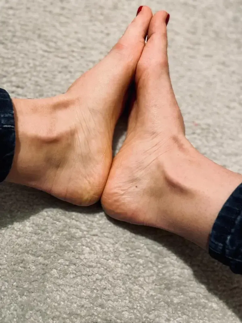 Leak & nude 6 — Twin_toes