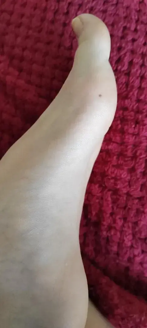Un grain de beauté sur chaque pied, un bien caché et l'autre bien visible... Lequel tu préfères ?