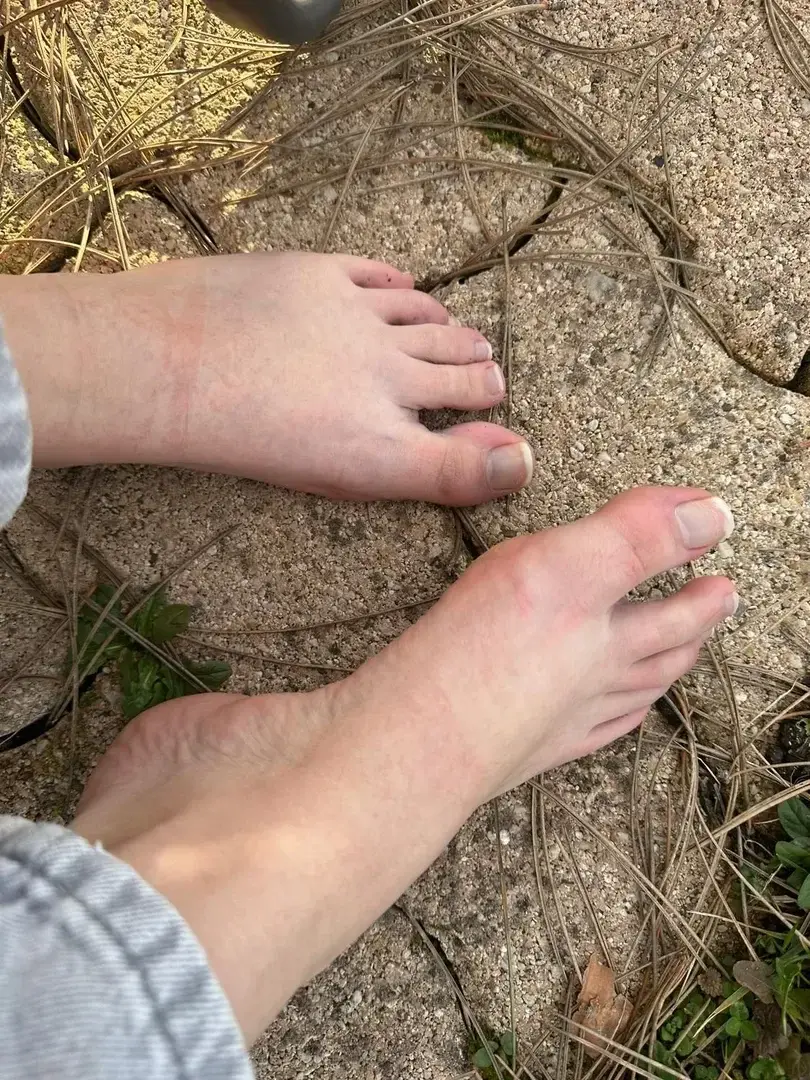 Photo de mes pieds aujourd’hui