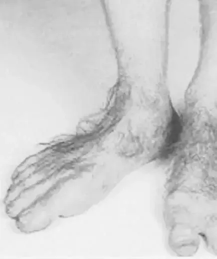 Leak & nude 5 — _mymosa_
