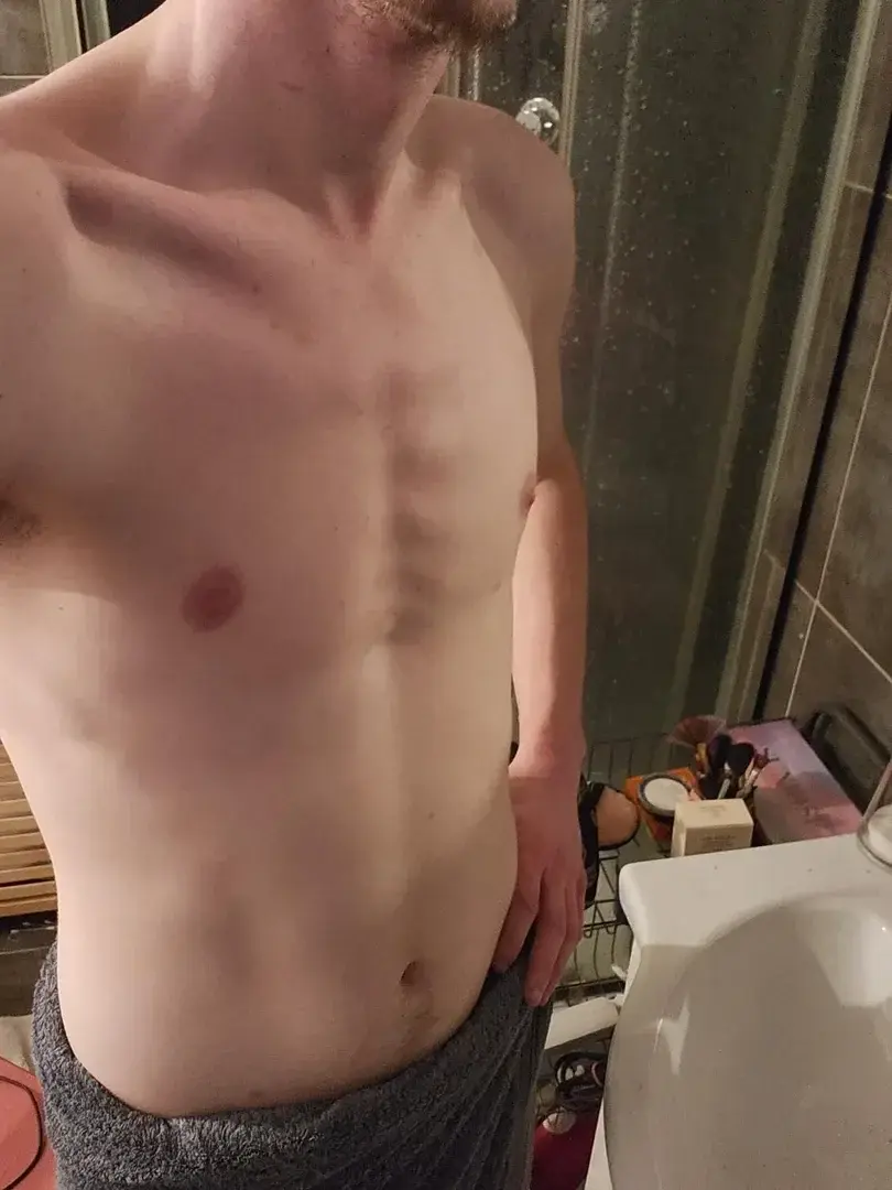 Leak & nude 1 — Koshida