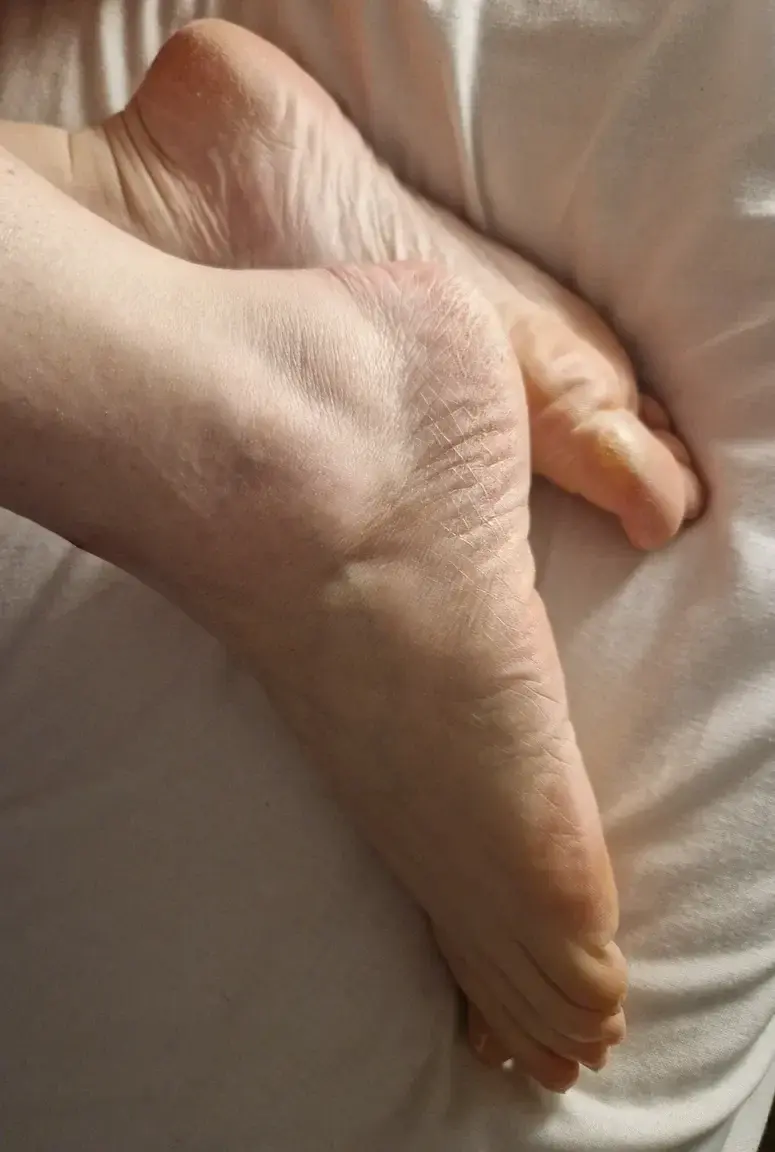 Leak & nude 1 — Hand-foot