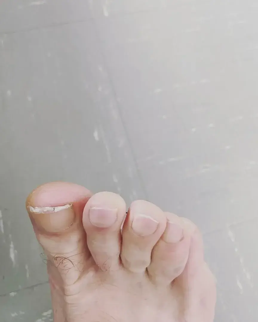 Photo de couverture de Feetmim