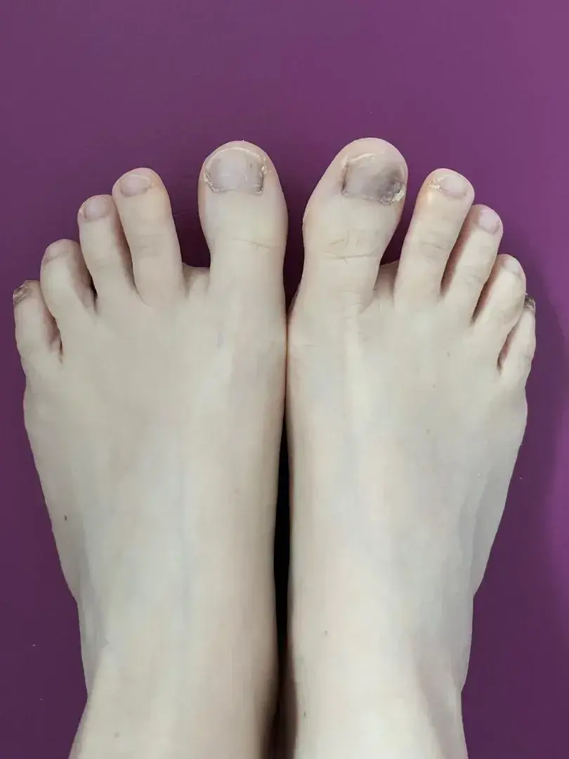 Leak & nude 1 — Feetonfire69