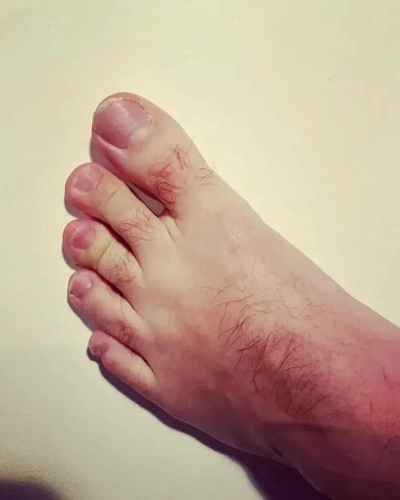 Leak & nude 4 — Talesoffeet