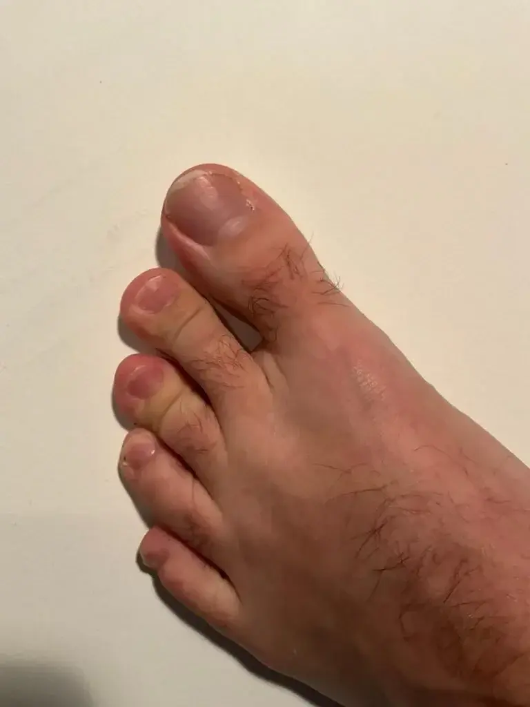 Leak & nude 7 — Talesoffeet