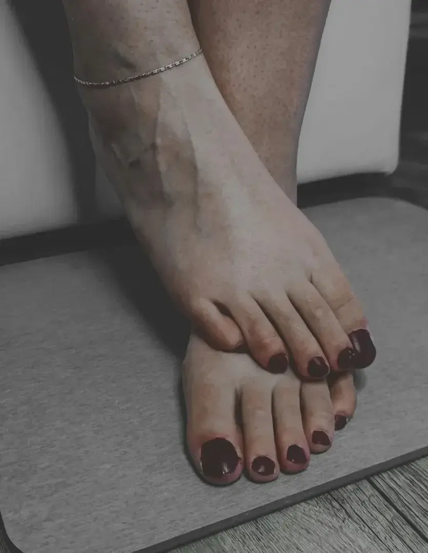 Leak & nude 3 — _ashii_feet-legs