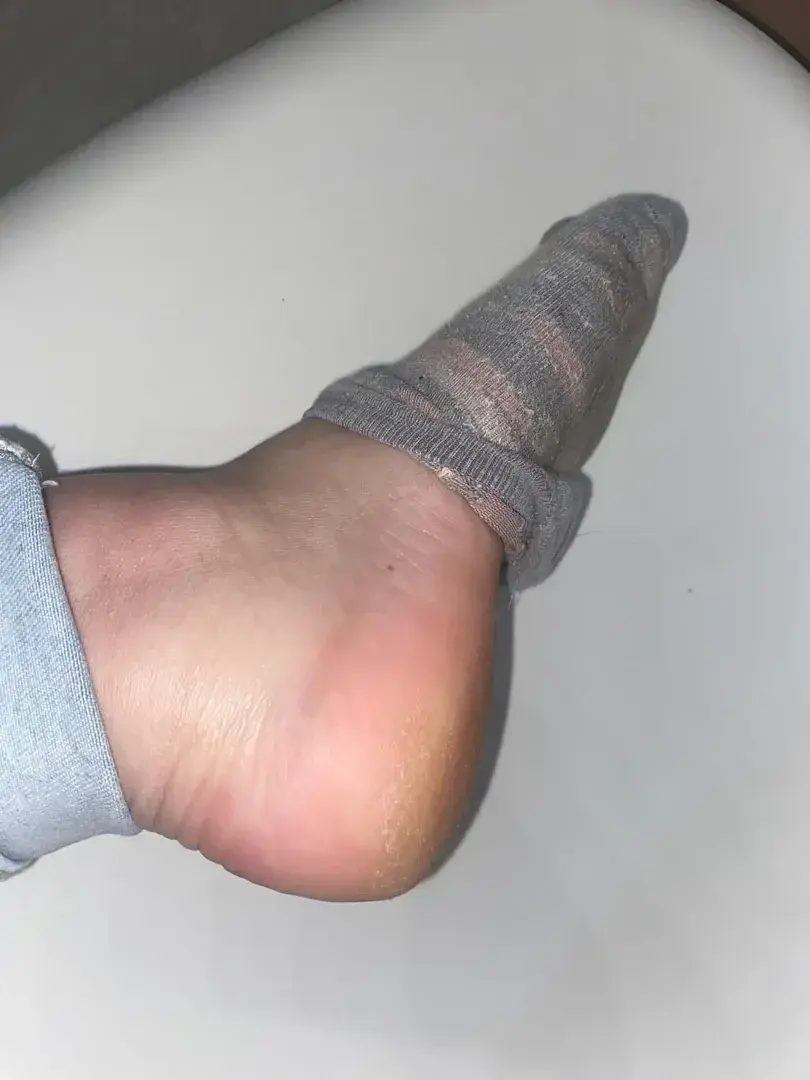 Leak & nude 2 — Leacells29