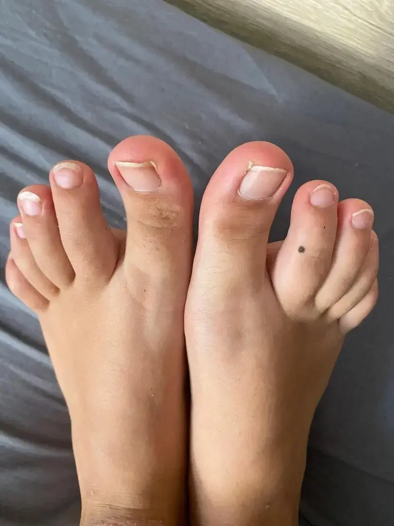 Leak & nude 3 — Lindfeet11
