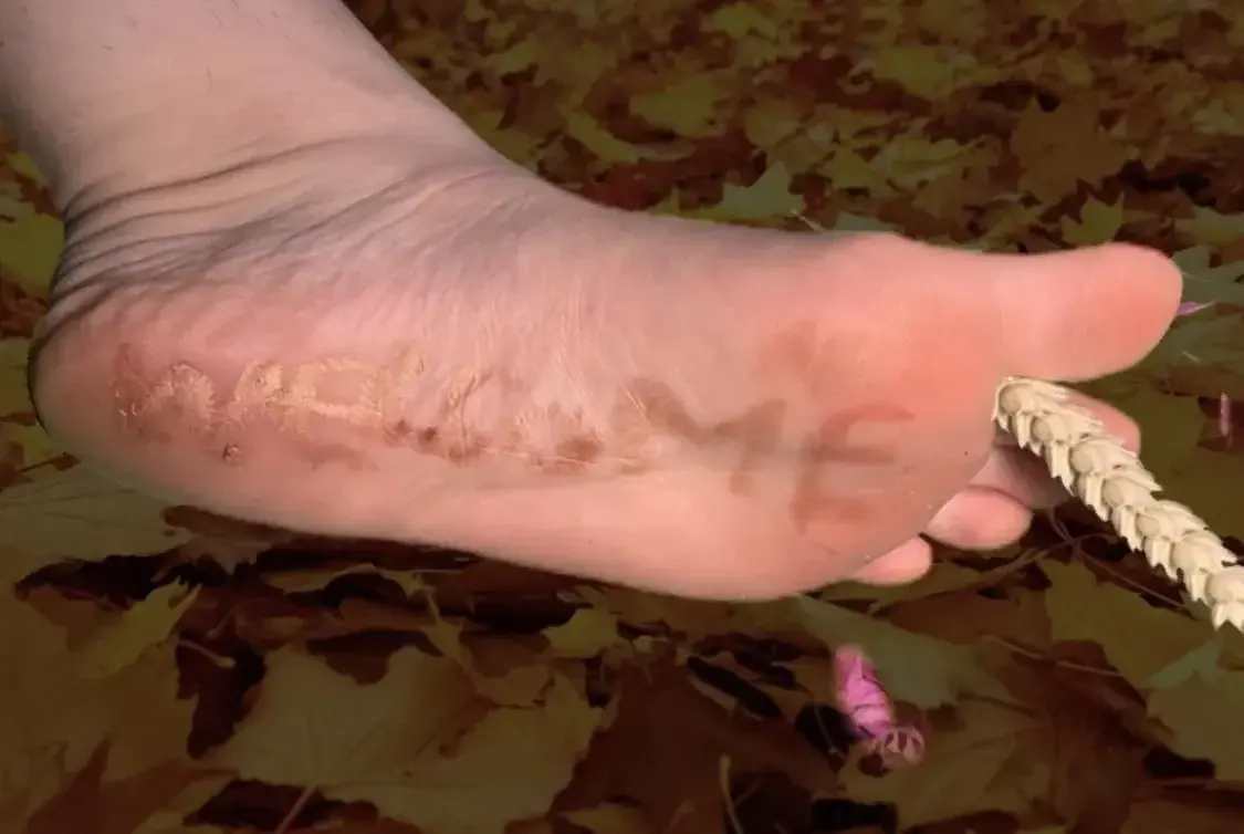 Photo de couverture de Stolz-feet