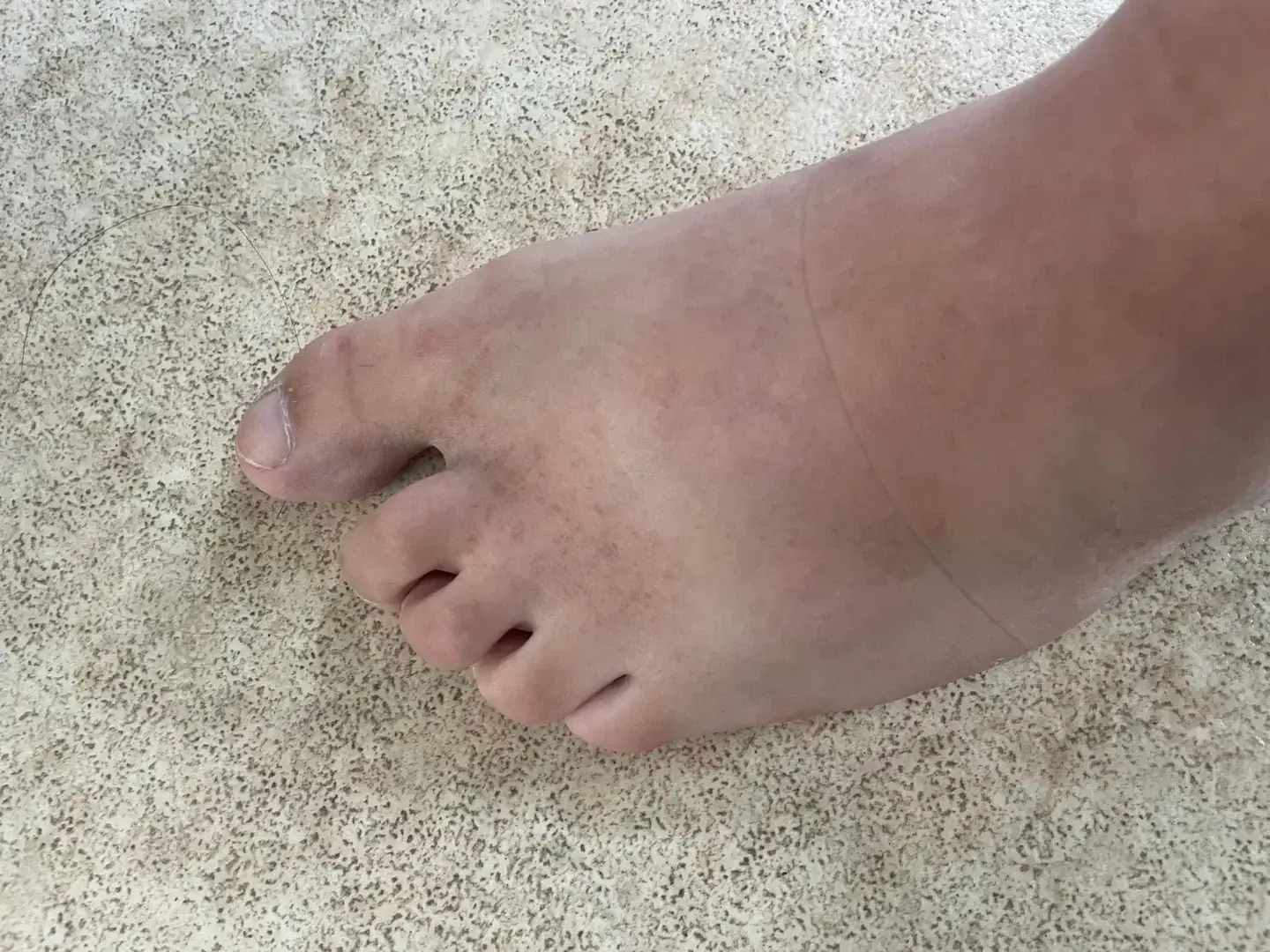 Leak & nude 1 — French___foot