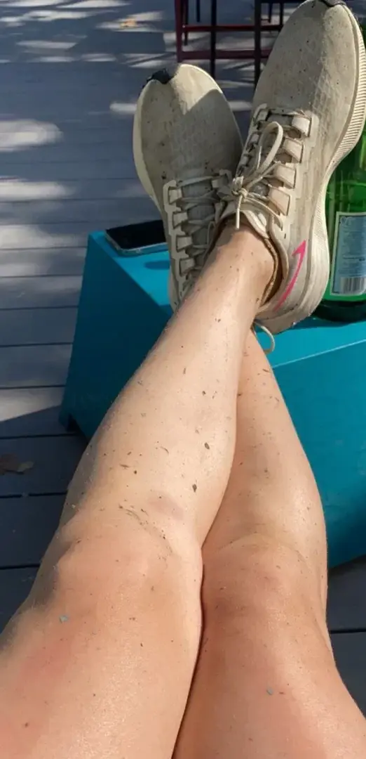 Leak & nude 11 — Missbeautyfeets