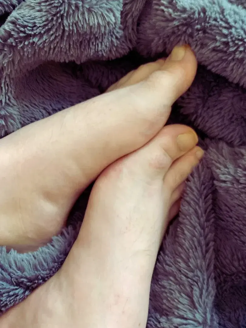 Leak & nude 2 — La-fille-au-cerf