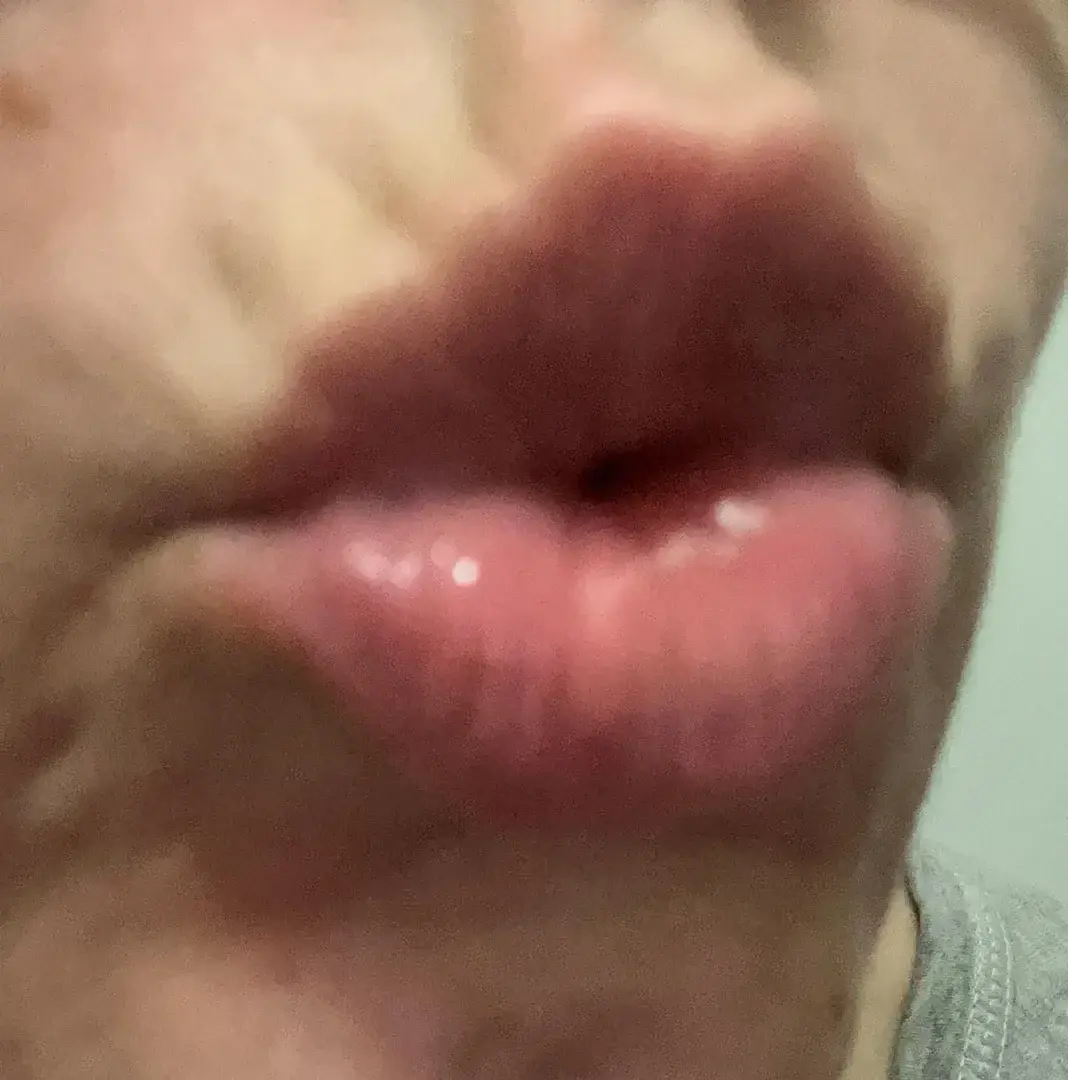 kiss