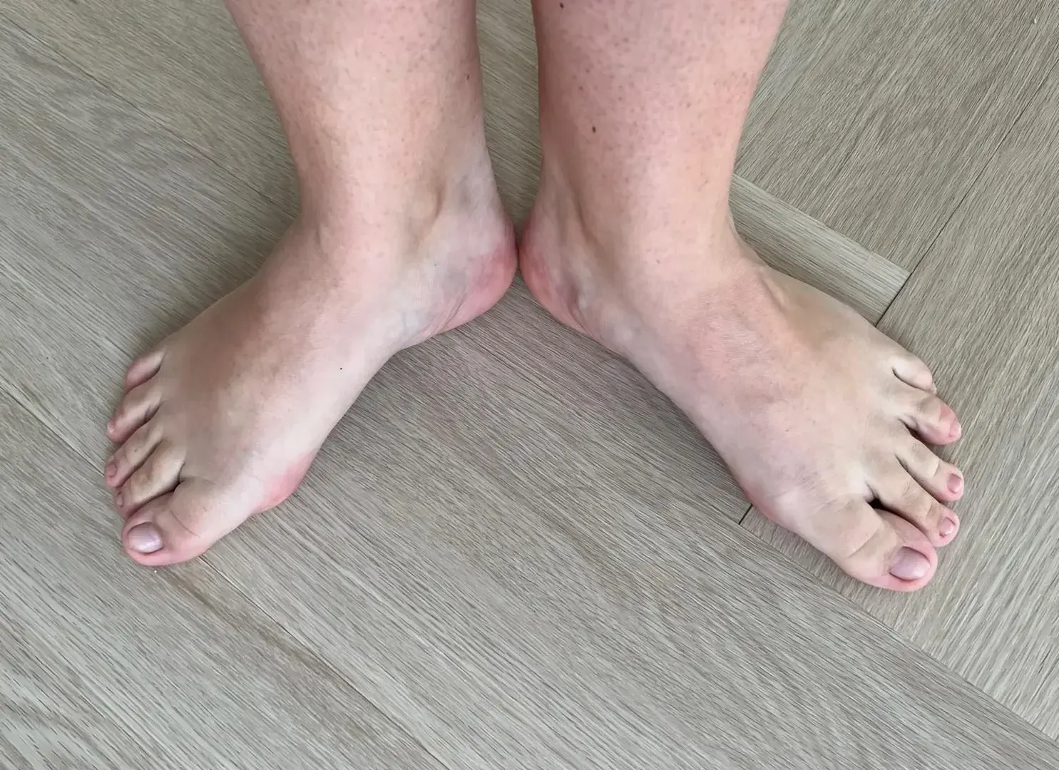 Leak & nude 1 — Piedsenflammeurs