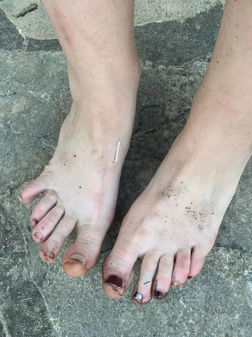naturalfeets👣😏