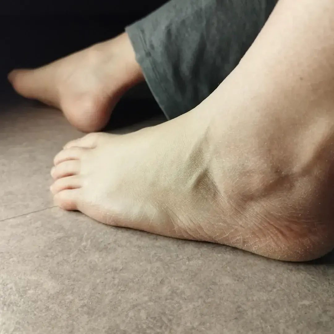 Avatar de Katarinafeet
