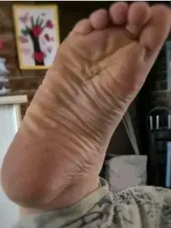 Leak & nude 2 — Joliepetitpied_peton