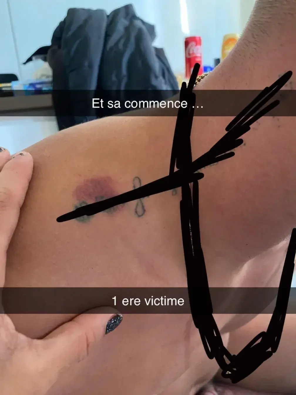 Kimyyy - Photo exclusive MYM 4 | French Modèles