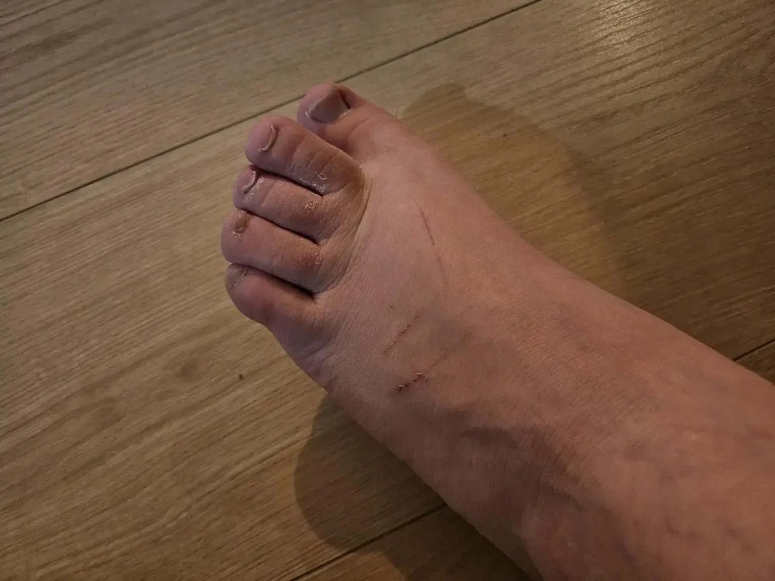 Avatar de Uglyfeets45