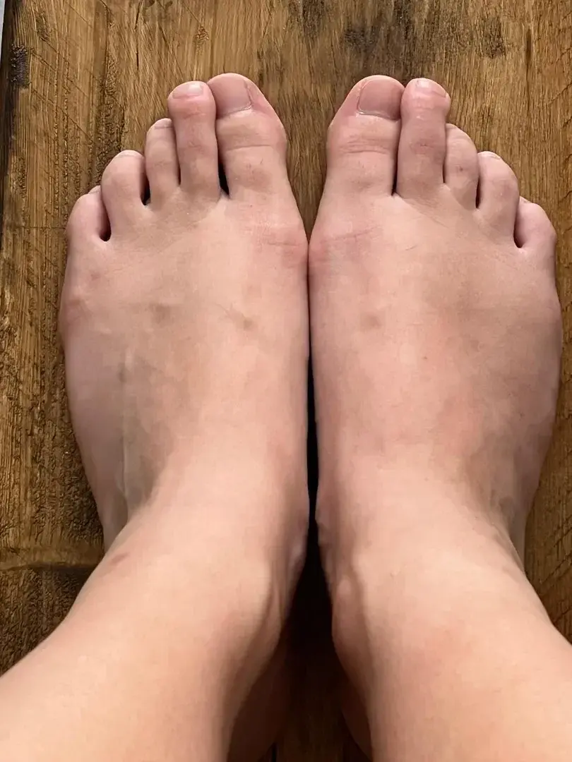 Leak & nude 1 — Mespiedsplats
