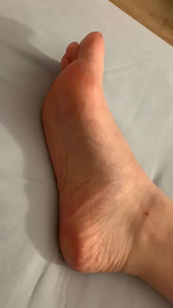 Oops I hurt myself 😢XOXO🌸