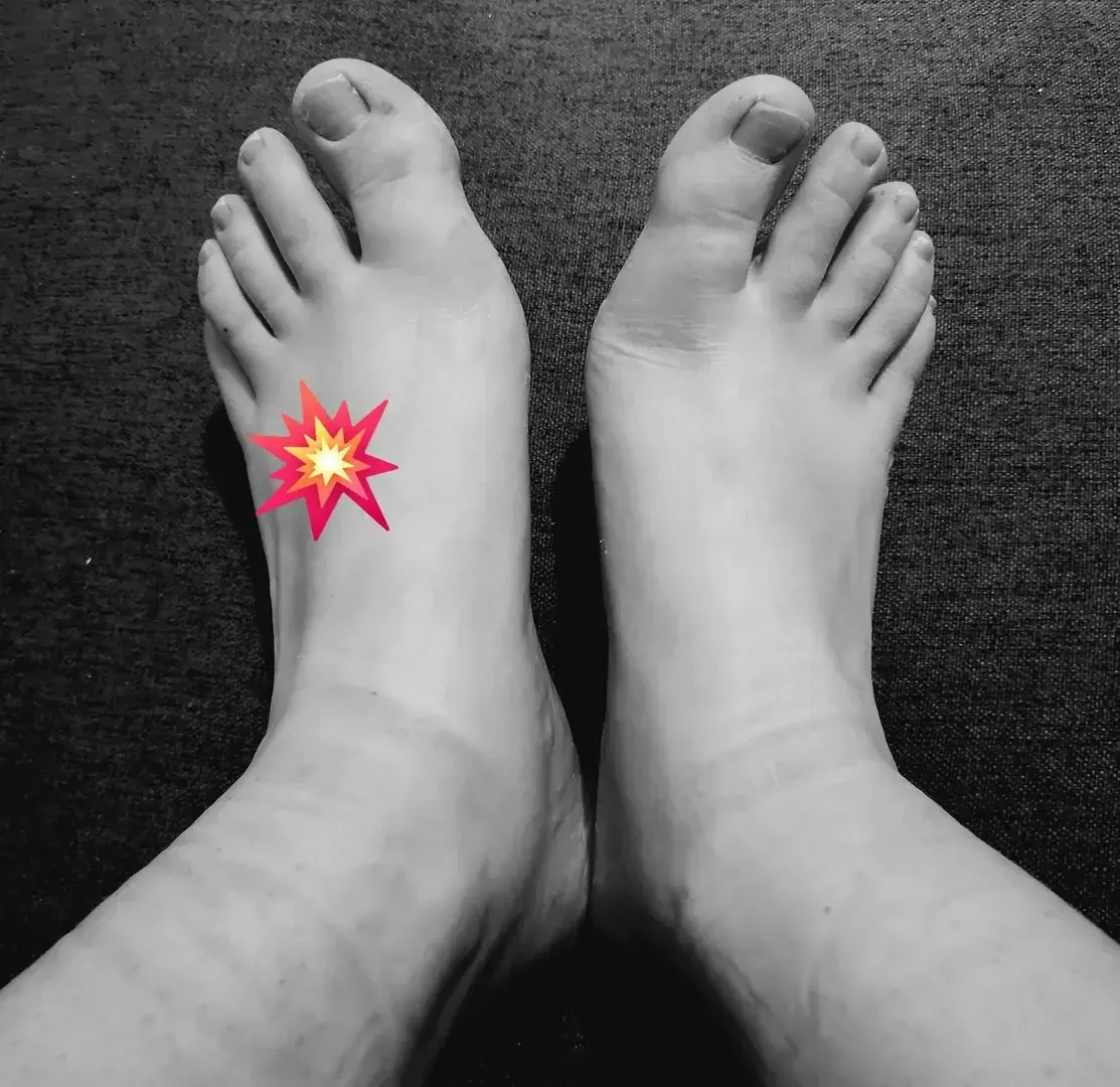 Leak & nude 2 — Kinkyfeet69