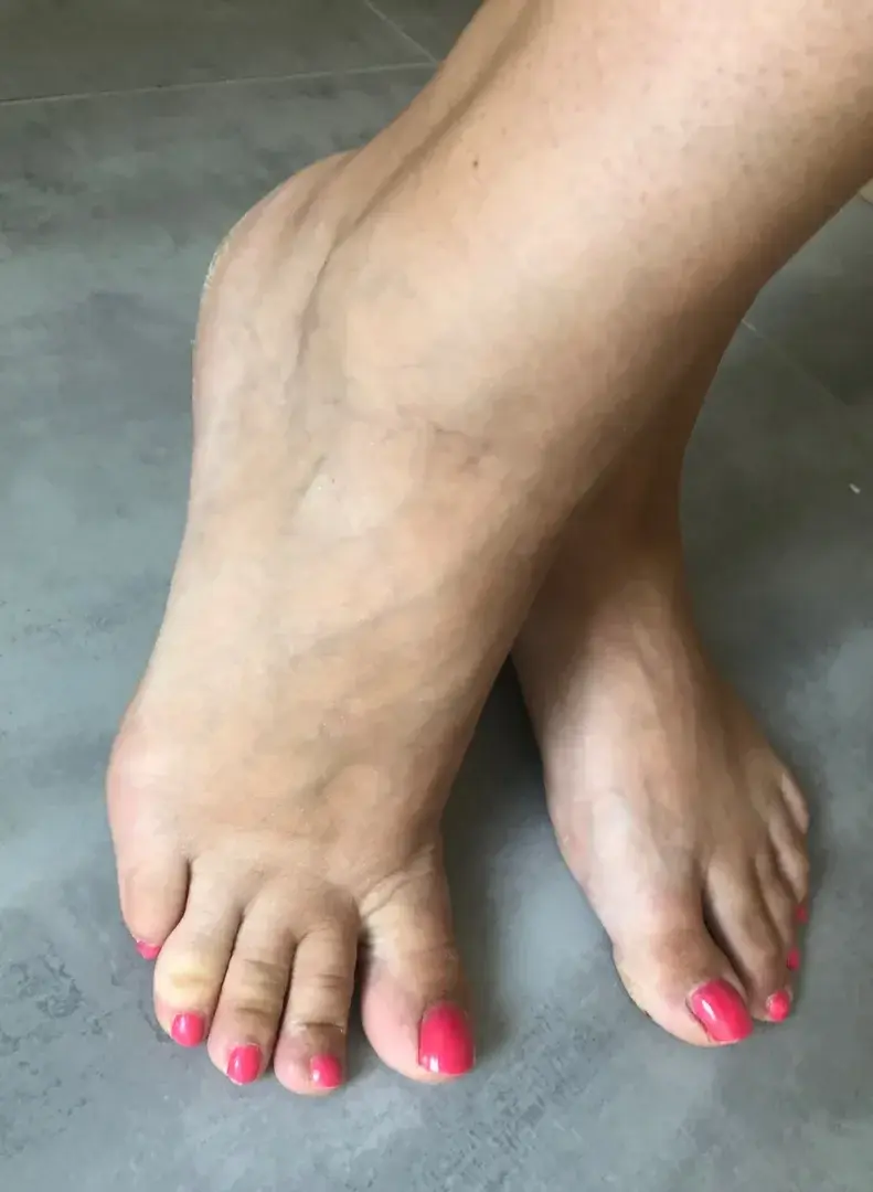 Leak & nude 2 — Lespiedsdetavoisine