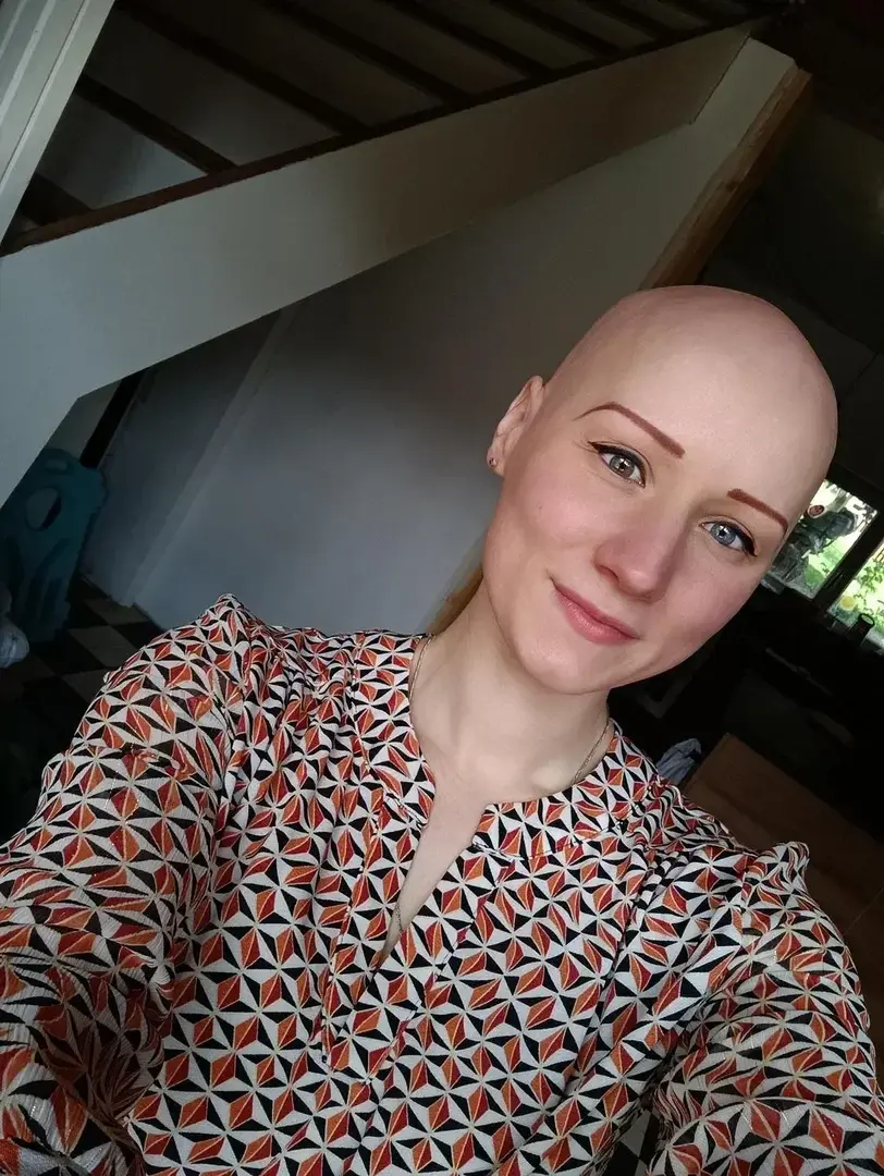 Avatar de Analopecia60