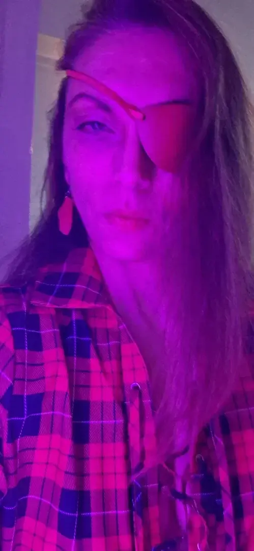 la femme est unique et moi je m'aime avec mon cache oeil .... cela me rend speciale non ? xoxo mon petit choux