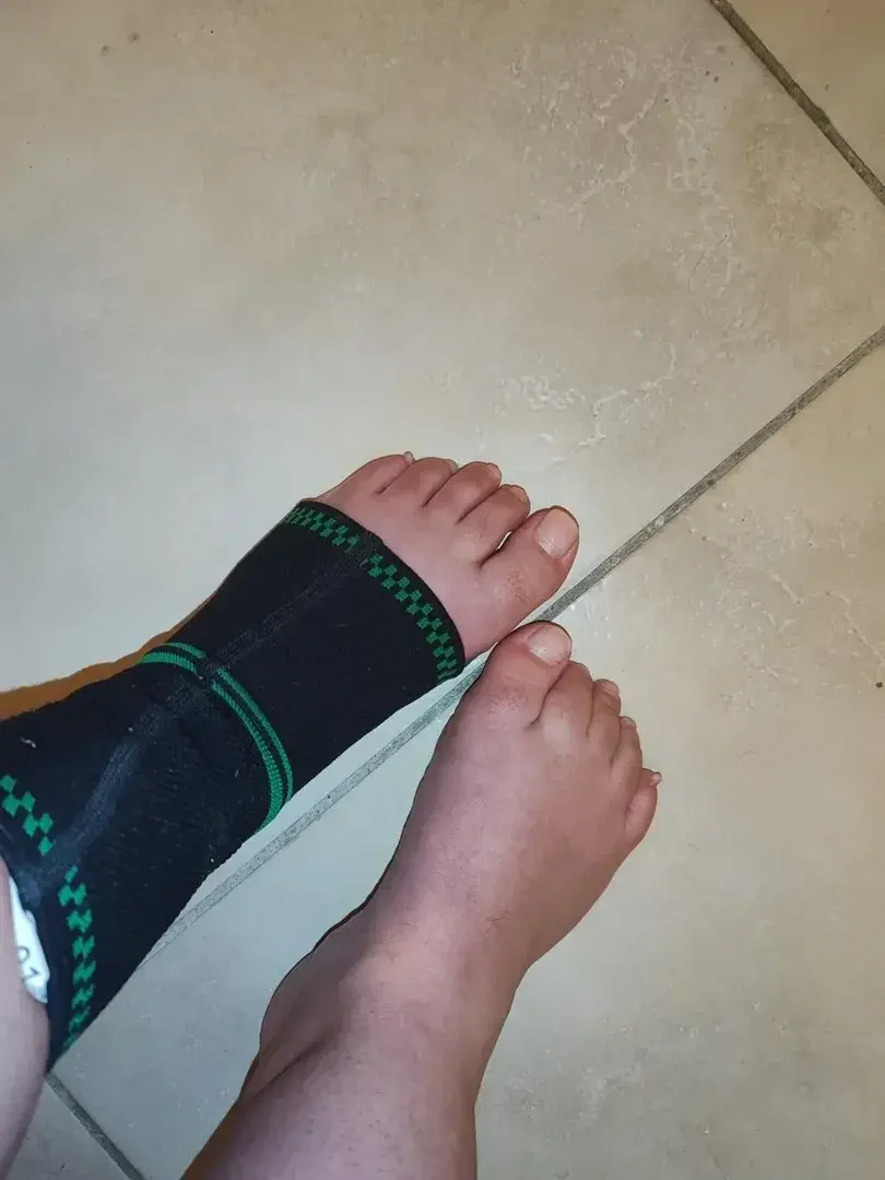 Oupsi petit accident 🙁 belle journée ☀️