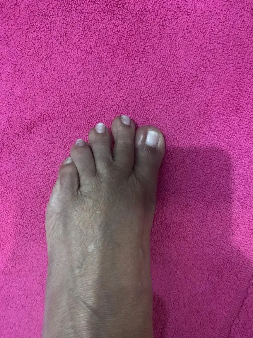 Leak & nude 2 — fleurdeguyane