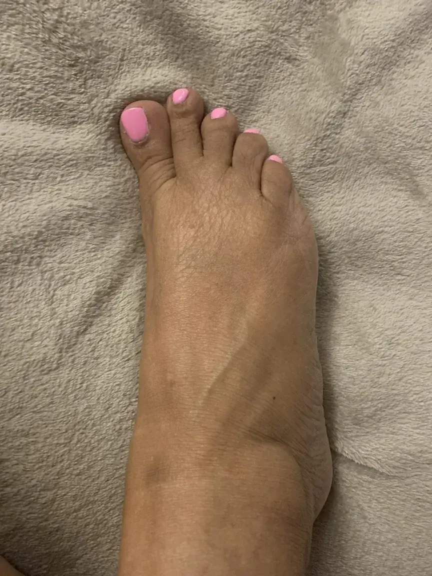 Leak & nude 3 — fleurdeguyane