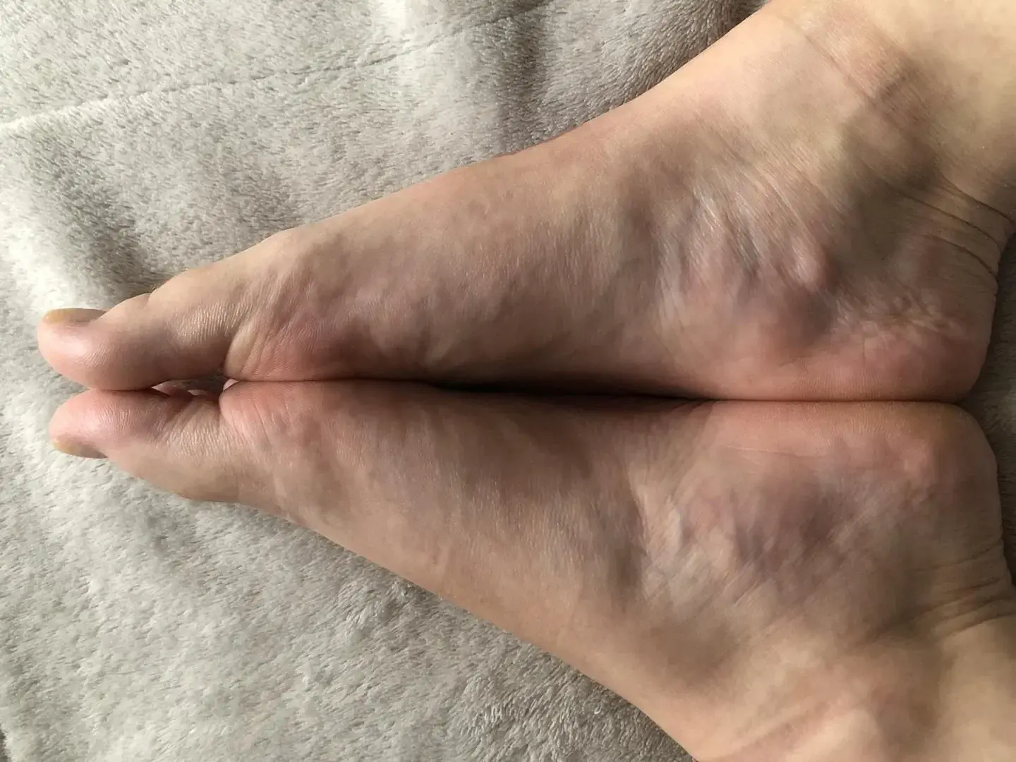Photo de couverture de Flowerbarefeet