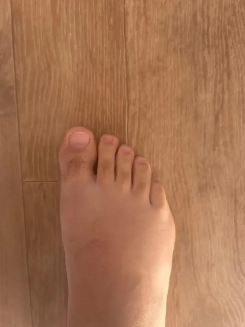 Leak & nude 1 — Kg83300