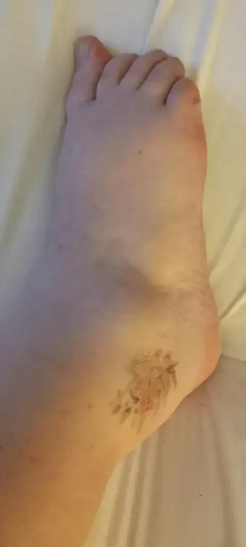 Leak & nude 10 — Chamalowdesiles