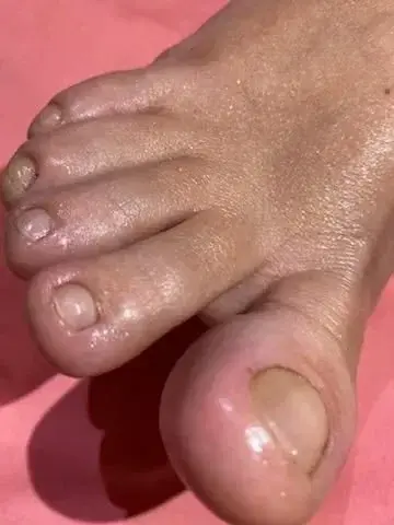 Leak & nude 1 — Bigfeetlove