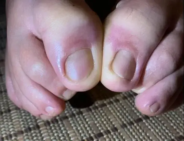 Photo de couverture de Bigfeetlove