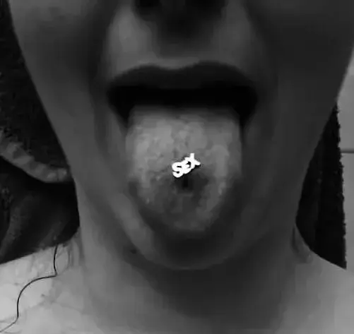 Avatar de Houlaoops