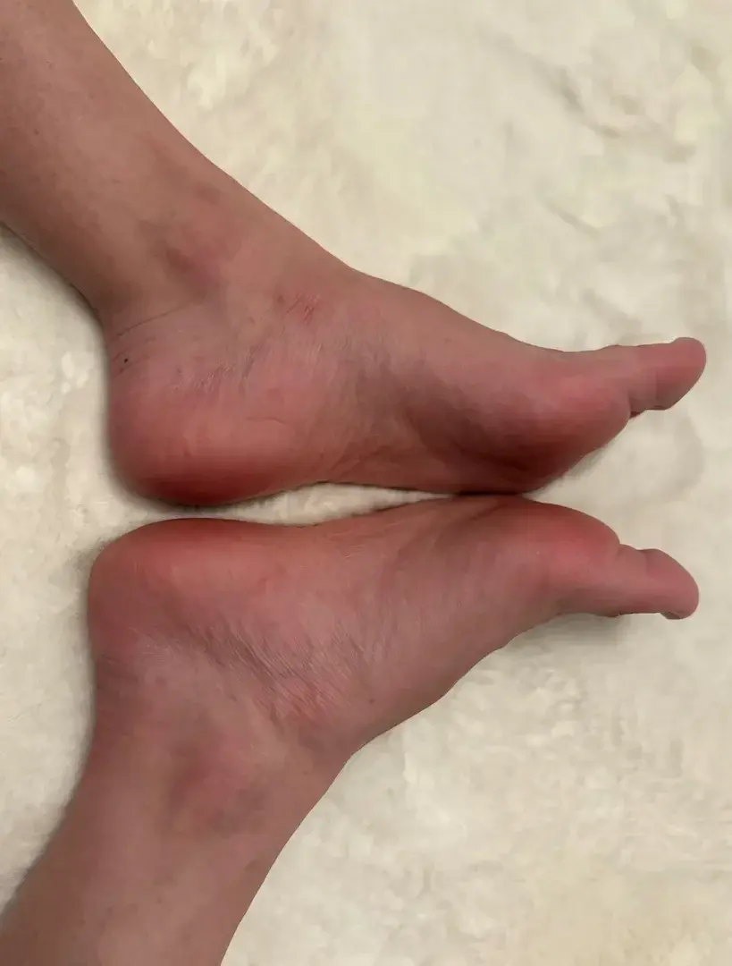 Leak & nude 3 — _petitpied2_