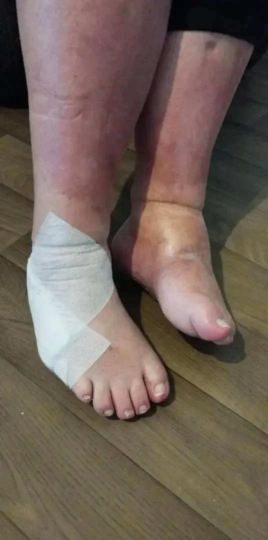 Leak & nude 2 — droledepieds