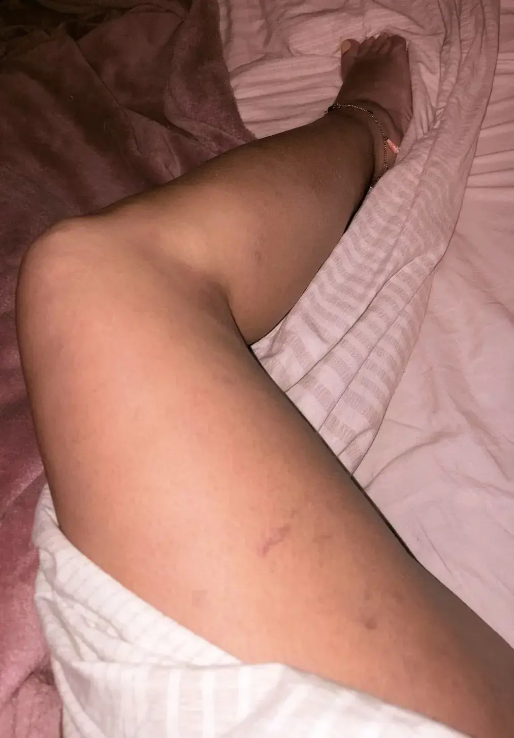 Leak & nude 12 — Eilime