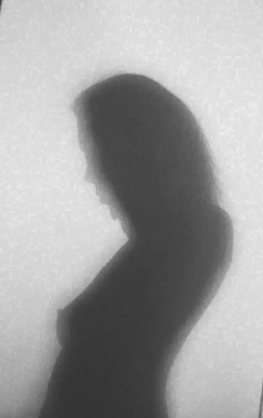 Leak & nude 1 — Lyrialux