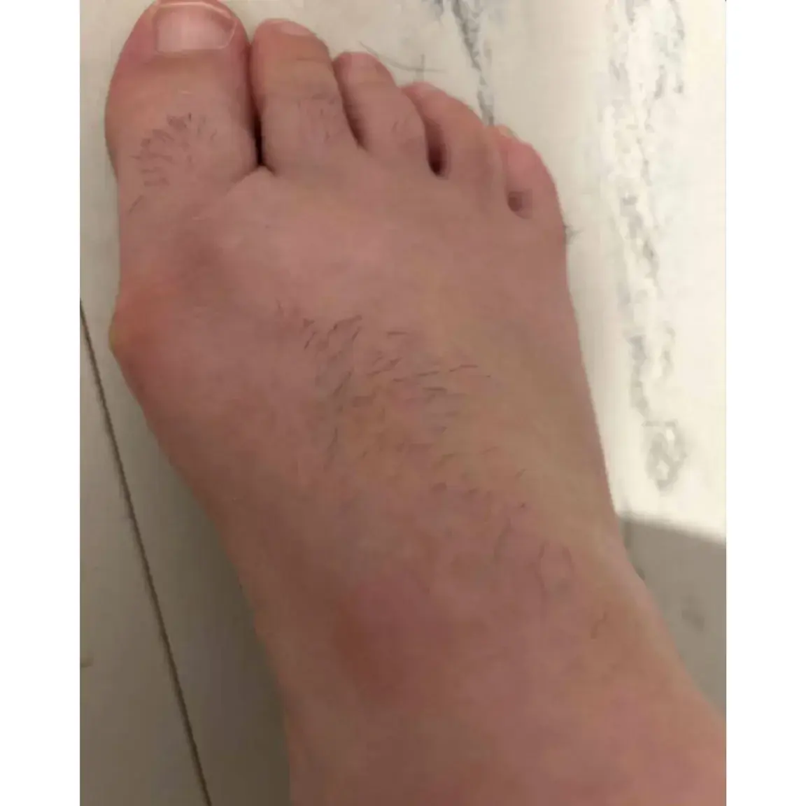 Leak & nude 1 — Wild_toes25
