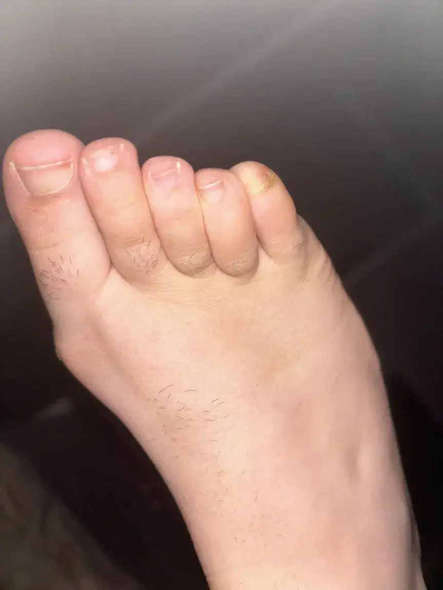 Leak & nude 3 — Wild_toes25