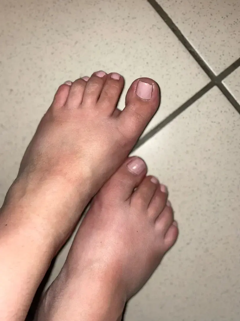 Leak & nude 1 — Piedmamm