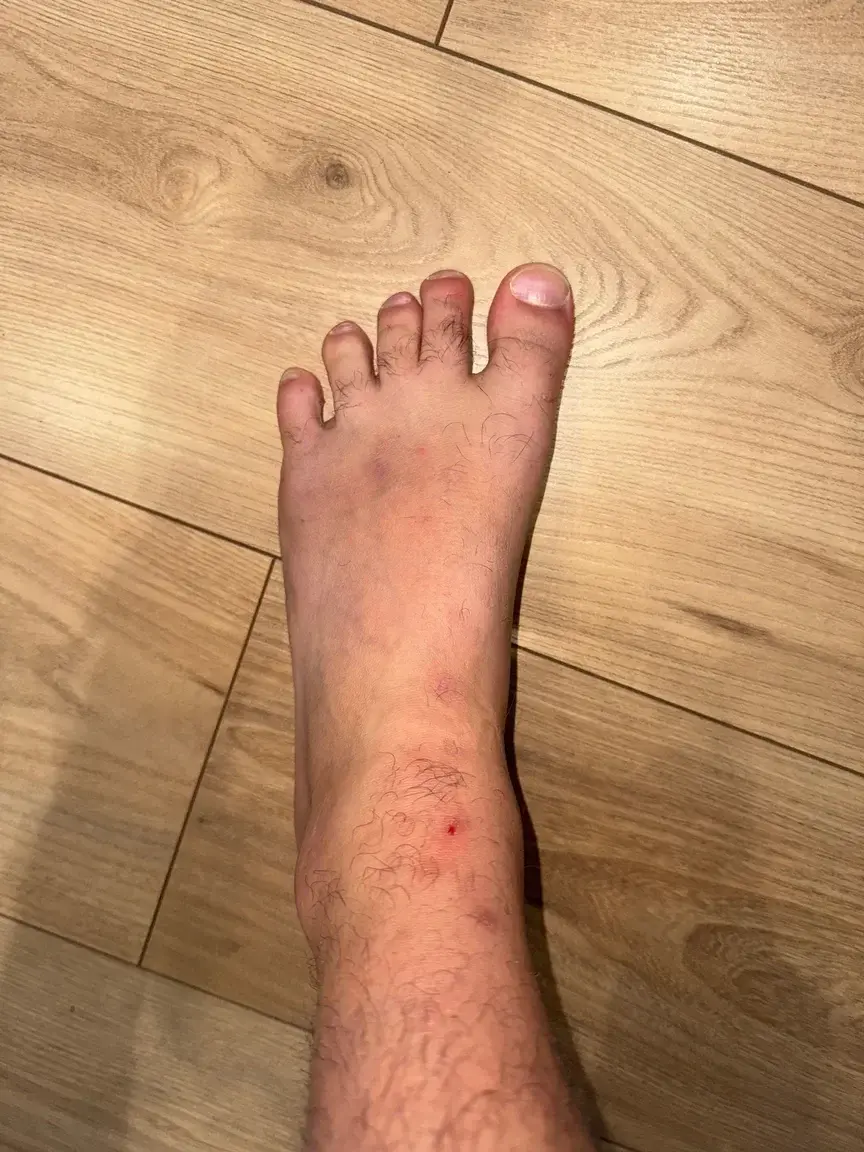 Leak & nude 1 — Onlyfoot_french